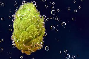 肾移植术后应用抗人T细胞免疫球蛋白逆转急性排异反应的观察与护理