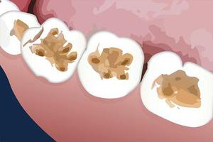 组织块法培养成体人牙髓细胞的增殖及分化状态