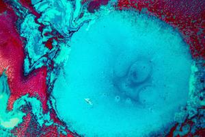 肾嫌色细胞癌的CT征象与MVD及Ki67表达的相关性研究