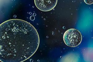 尼洛替尼治疗慢性粒细胞白血病的研究进展